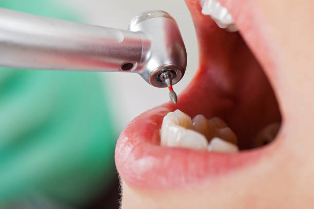 Best Emergency Broken Tooth Repair in Braddock, VA